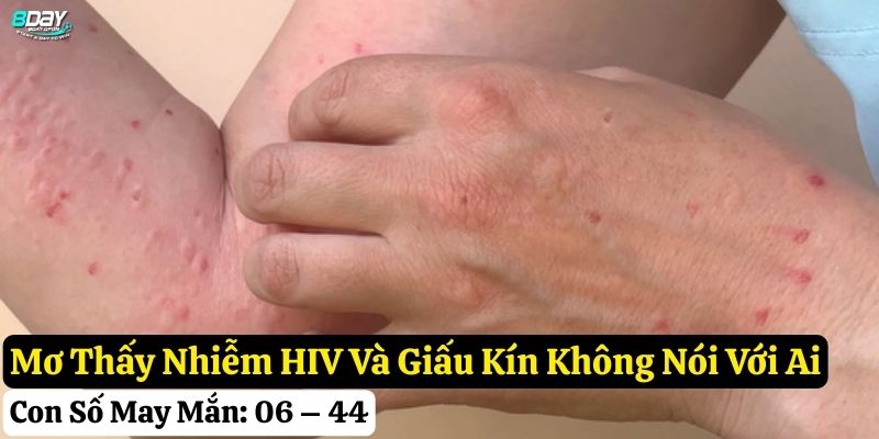 nằm mơ thấy nhiễm HIV