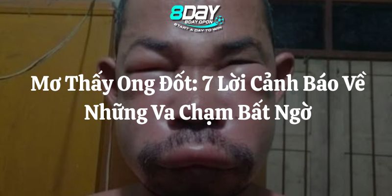 mơ thấy ong đốt 8day thumb